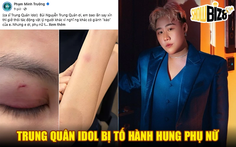 Trung Quân Idol Bị Tố Hành Hung Phụ Nữ